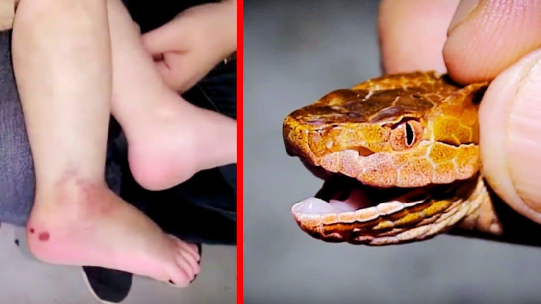 Venomous Copperhead Snake Bites 2YearOld Boy In South Carolina Country Music Nation