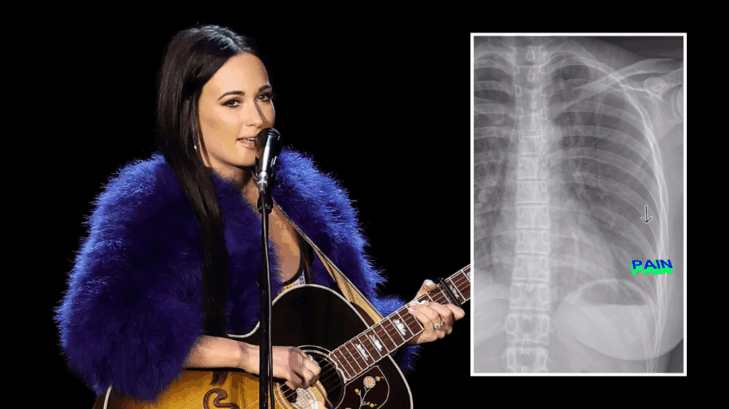 kacey musgraves broken rib