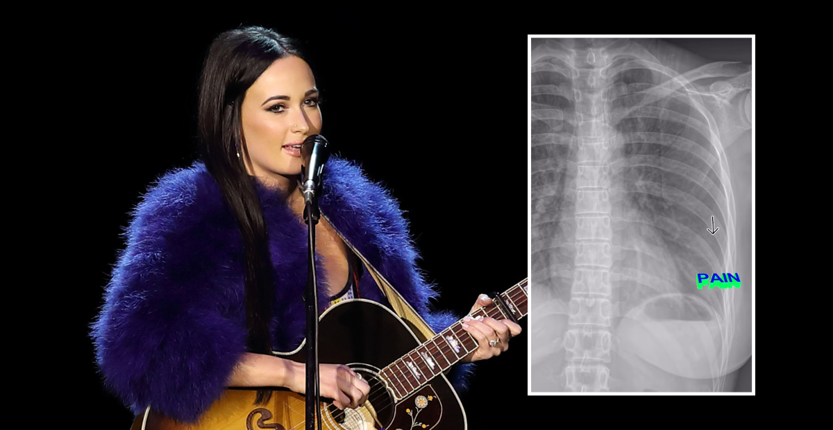 Kacey Musgraves Breaks Her Rib After Falling "Extremely Hard" During A