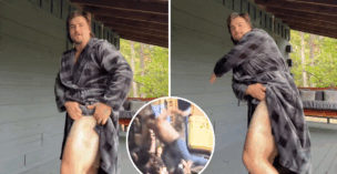 Gavin Adcock shows off the bruise from falling off stage